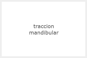 m2_tracc_mand