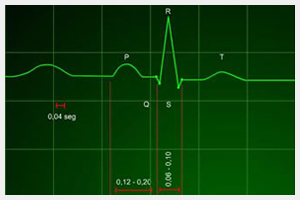 analisis ritmo cardiaco