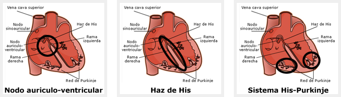 interpretacion ritmo cardiaco