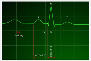 interpretacion ritmo cardiaco