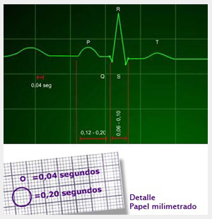 interpretacion ritmo cardiaco