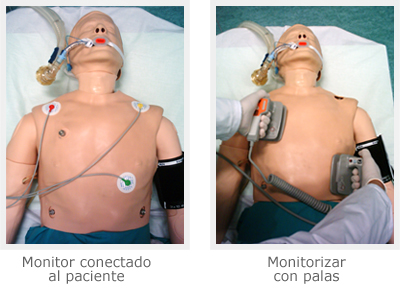 monitorizacin cardiaca