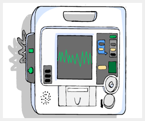 trastorno electrico ritmo cardiaco